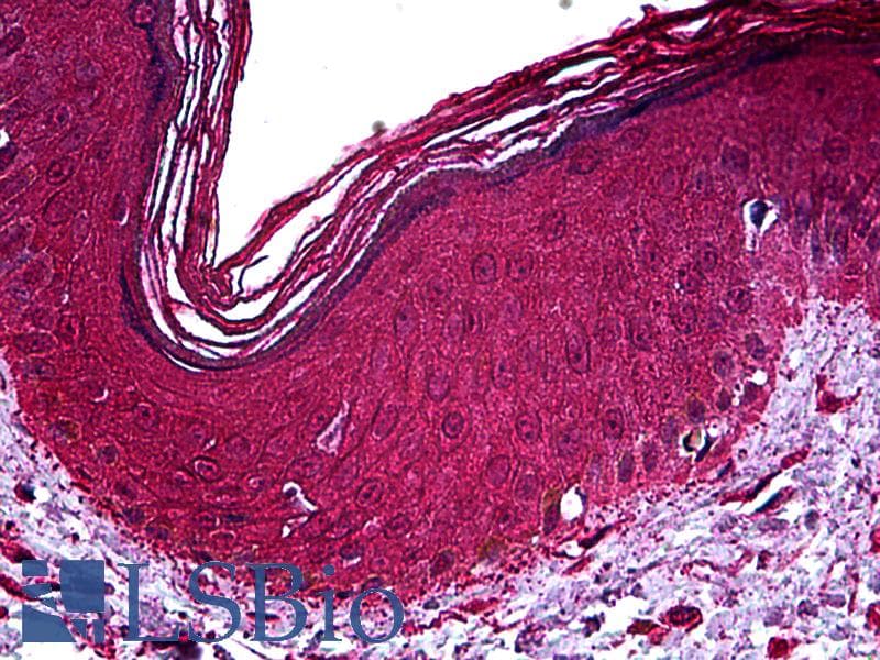 IHC-plus™ NR2C2 / TAK1 Antibody (clone 2A5)