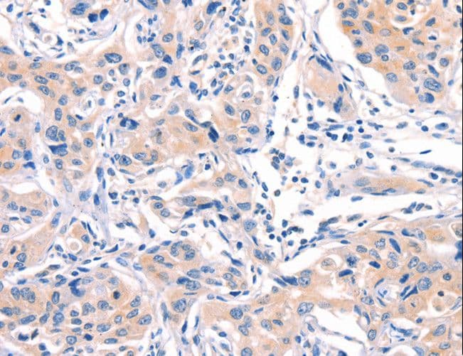 Polyclonal Rabbit anti-Human MLLT4 / Afadin Antibody (IHC)