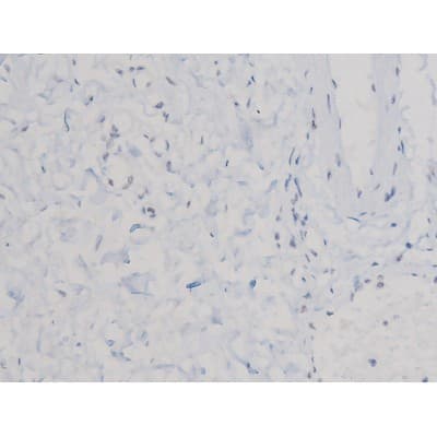 CDC25A Antibody (phospho-Ser75)