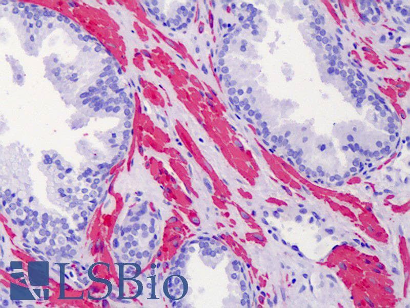 PathPlus™ ACTG2 Antibody (aa1-50)
