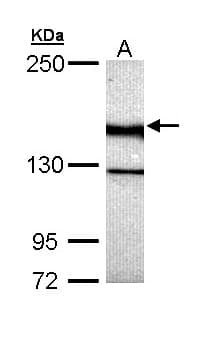 UNC13B Antibody (aa462-749)