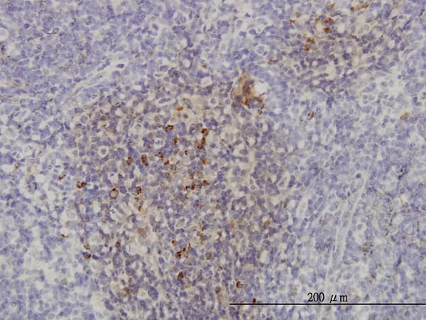 PIK3CB / PI3K Beta Antibody (clone 4H2)