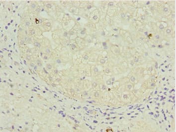 Polyclonal Rabbit anti-Human TAF5 Antibody (IHC, WB)