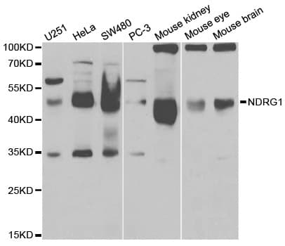 PathPlus™ NDRG1 Antibody