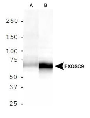 EXOSC9 / p5 Antibody
