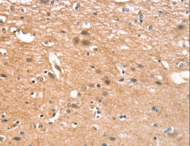 CYLD Antibody