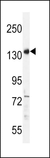 PALB2 Antibody (aa546-574)
