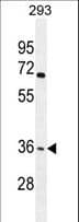 Polyclonal Rabbit anti-Human OR4F15 Antibody (aa69-96, WB)