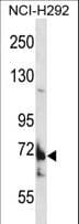 TMC8 / EVER2 Antibody (aa50-79)