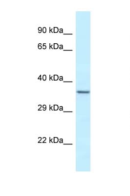 EXOSC9 / p5 Antibody (N-Terminus)