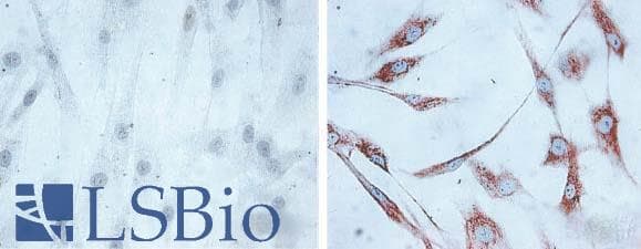 HSPD1 / HSP60 Antibody (clone LK-1)