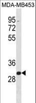 ZNF367 Antibody (aa299-327)
