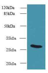 UTP23 Antibody