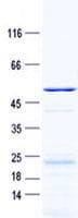 Human SLC25A10 / DIC Protein (Recombinant GST, N-terminus + His, C-terminus)