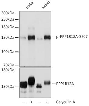Polyclonal Rabbit anti-Human PPP1R12A / MYPT1 Antibody (phospho-Ser507, WB)