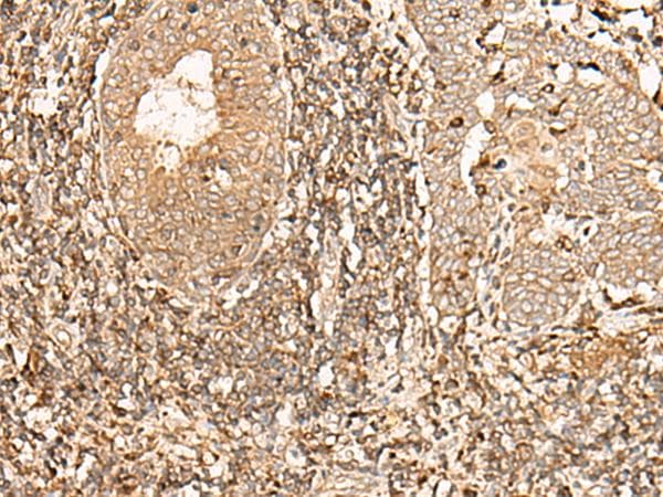 GALR2 / Galanin Receptor 2 Antibody