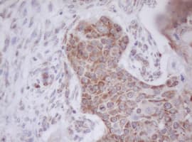 IF3mt / MTIF3 Antibody (aa56-278, clone OTI1E8)