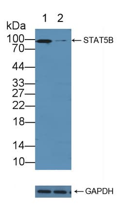 STAT5B Antibody (aa497-749)