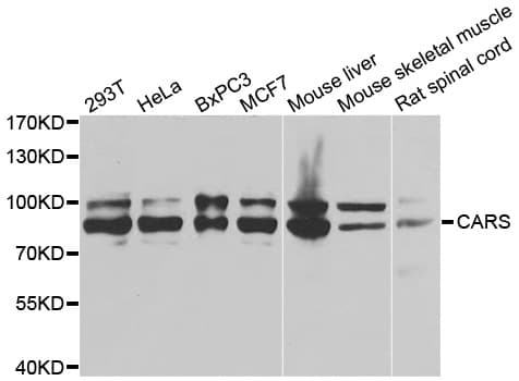 IHC-plus™ CARS1 / CARS Antibody