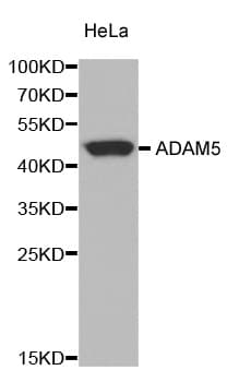 Polyclonal Rabbit anti-Human Adam5 Antibody (IHC, IF, WB)