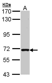 Polyclonal Rabbit anti-Human RASGRP2 Antibody (WB)