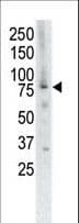 MUSK Antibody (aa829-859)