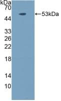 Human LOX / Lysyl Oxidase Protein (Recombinant His-GST, N-terminus)