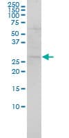 Monoclonal Mouse anti-Human SH3BGR Antibody (clone 3B7, IHC, WB)