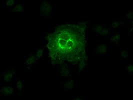 IHC-plus™ Monoclonal Mouse anti-Human SLC2A6 / GLUT6 Antibody (clone 7E3, IHC, IF, WB)