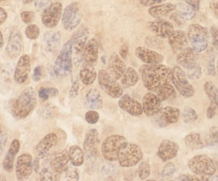 Polyclonal Rabbit anti-Human CUL2 / Cullin 2 Antibody (aa150-200, IHC)