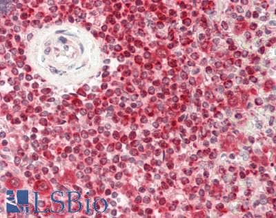 IHC-plus™ Polyclonal Rabbit anti-Human HSPE1 / HSP10 / Chaperonin 10 Antibody (aa38-64, IHC, WB)