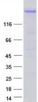 Human DICER1 / Dicer Protein (Recombinant Myc-DDK (Flag))