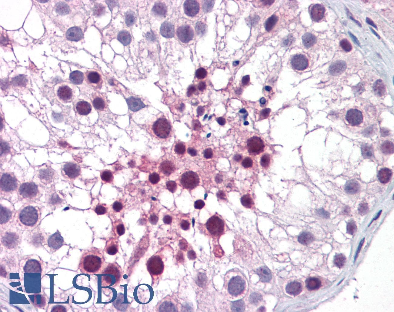 IHC-plus™ MED26 / CRSP7 Antibody (clone 2G10)