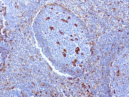 Vimentin Antibody (clone UMAB160, Carrier-free)