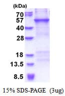Human CRTAP Protein (Recombinant His)