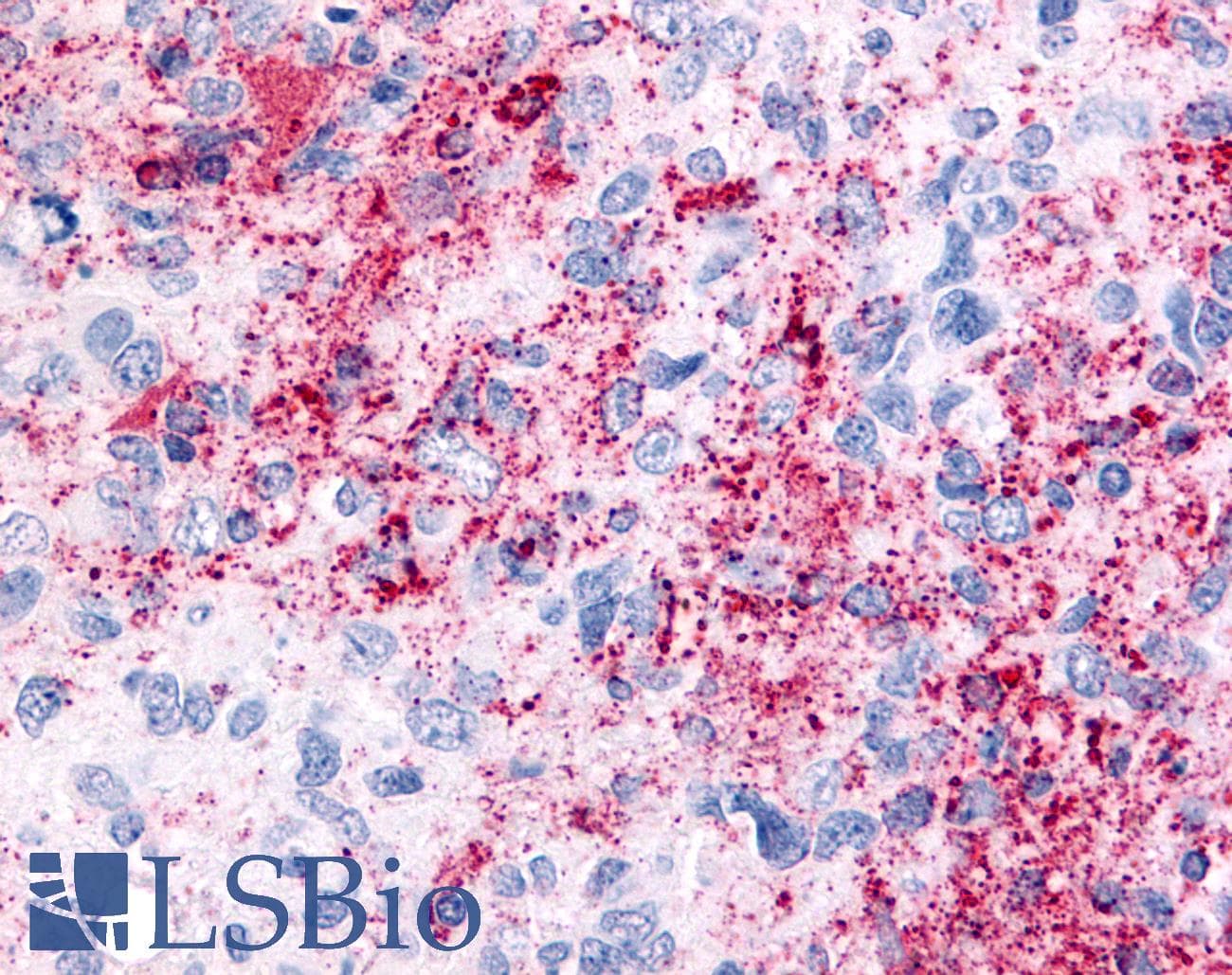 PathPlus™ VRL1 / TRPV2 Antibody (N-Terminus)