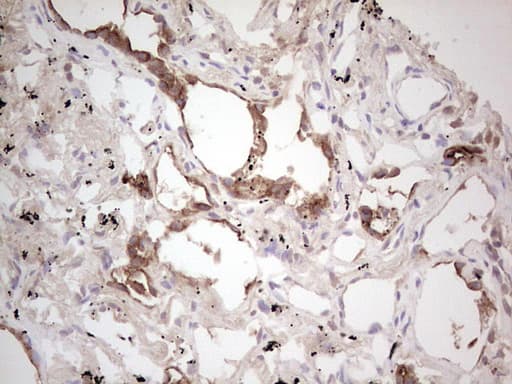 ROS1 / ROS Antibody (aa2126-2347, clone OTI1F3)