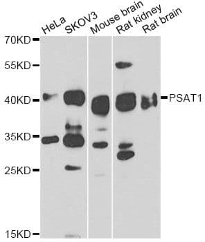 PSAT1 Antibody