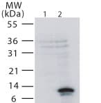 TNFRSF12A / TWEAK Receptor Antibody (aa104-118)