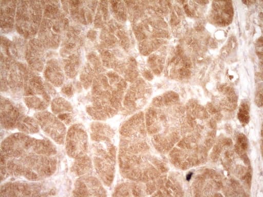 HGF / Hepatocyte Growth Factor Antibody (aa200-494, clone OTI2F3)