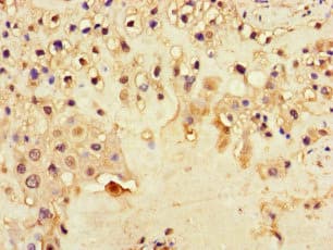 Polyclonal Rabbit anti-Human DNAH1 Antibody (IHC, IF)
