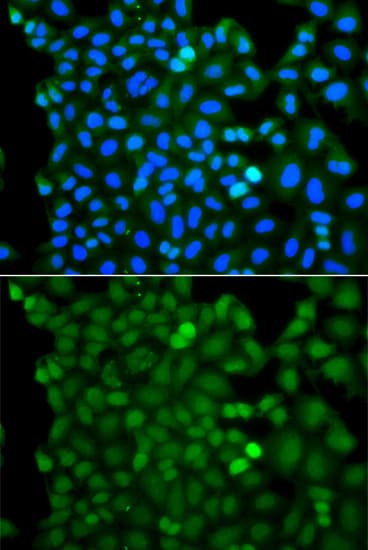 RNF125 / TRAC-1 Antibody