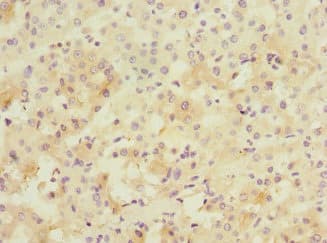 Polyclonal Rabbit anti-Human PPM1D / WIP1 Antibody (IHC, WB)