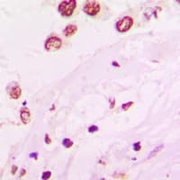 HKR1 Antibody (Internal)