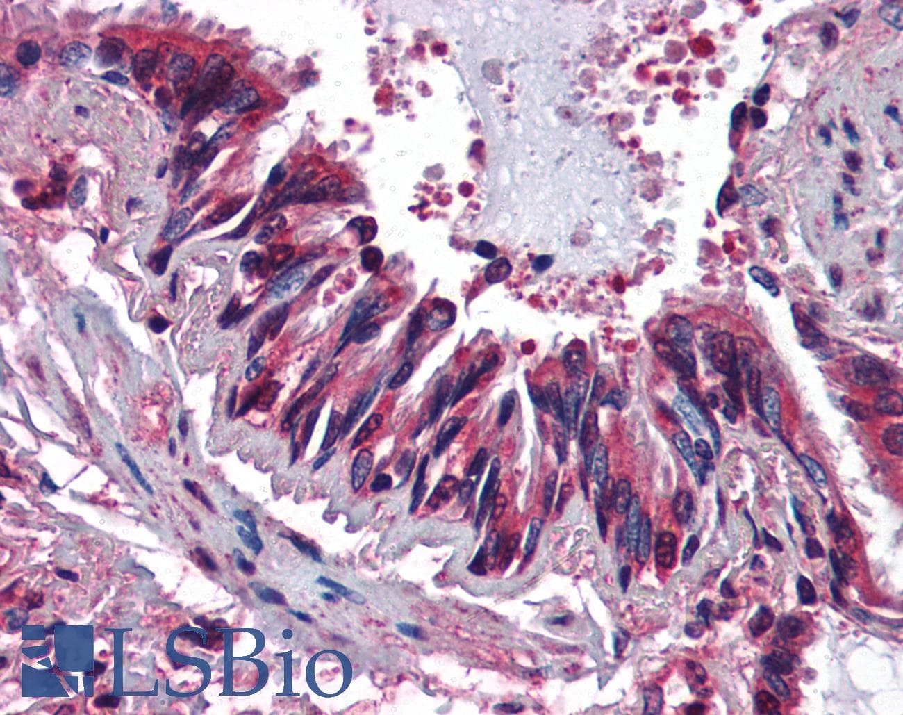 IHC-plus™ Monoclonal Mouse anti-Human CCR3 Antibody (clone 5E8, IHC)