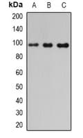 Polyclonal Rabbit anti-Human PDE6B / PDE6 Beta Antibody (WB)