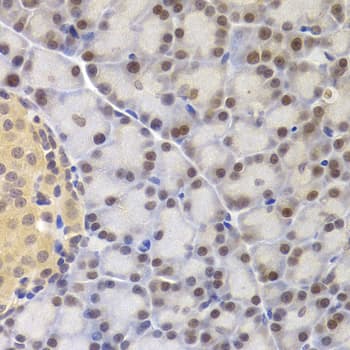 Polyclonal Rabbit anti-Human MCM4 Antibody (IHC, WB)