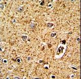 TPH1 / Tryptophan Hydroxylase Antibody (aa35-62)
