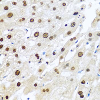 Polyclonal Rabbit anti-Human METTL3 Antibody (IHC, WB)