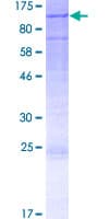 Human DHX40 Protein (Recombinant GST)